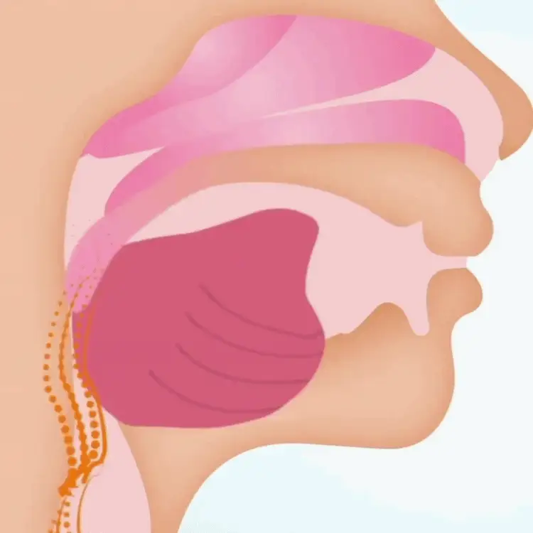 Illustration of a relaxed airway during sleep